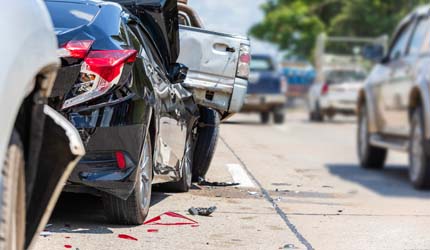 car accident - should I get a lawyer?