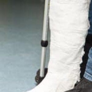 InjuredLeg